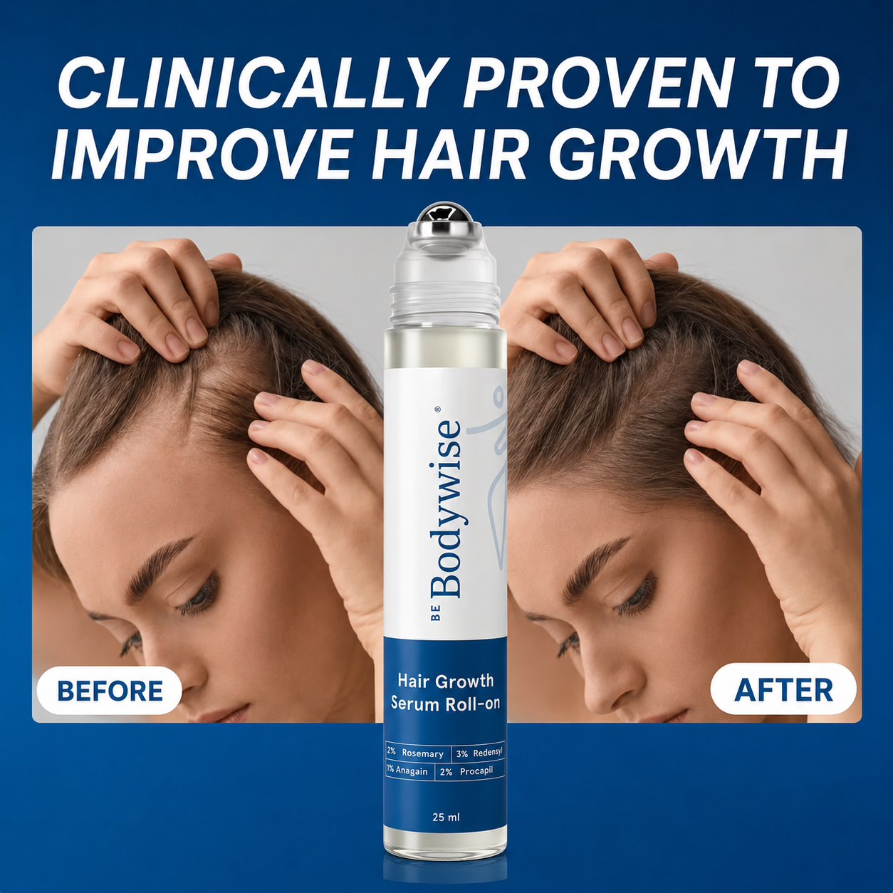 Bodywise Hair Growth Roll on Serum