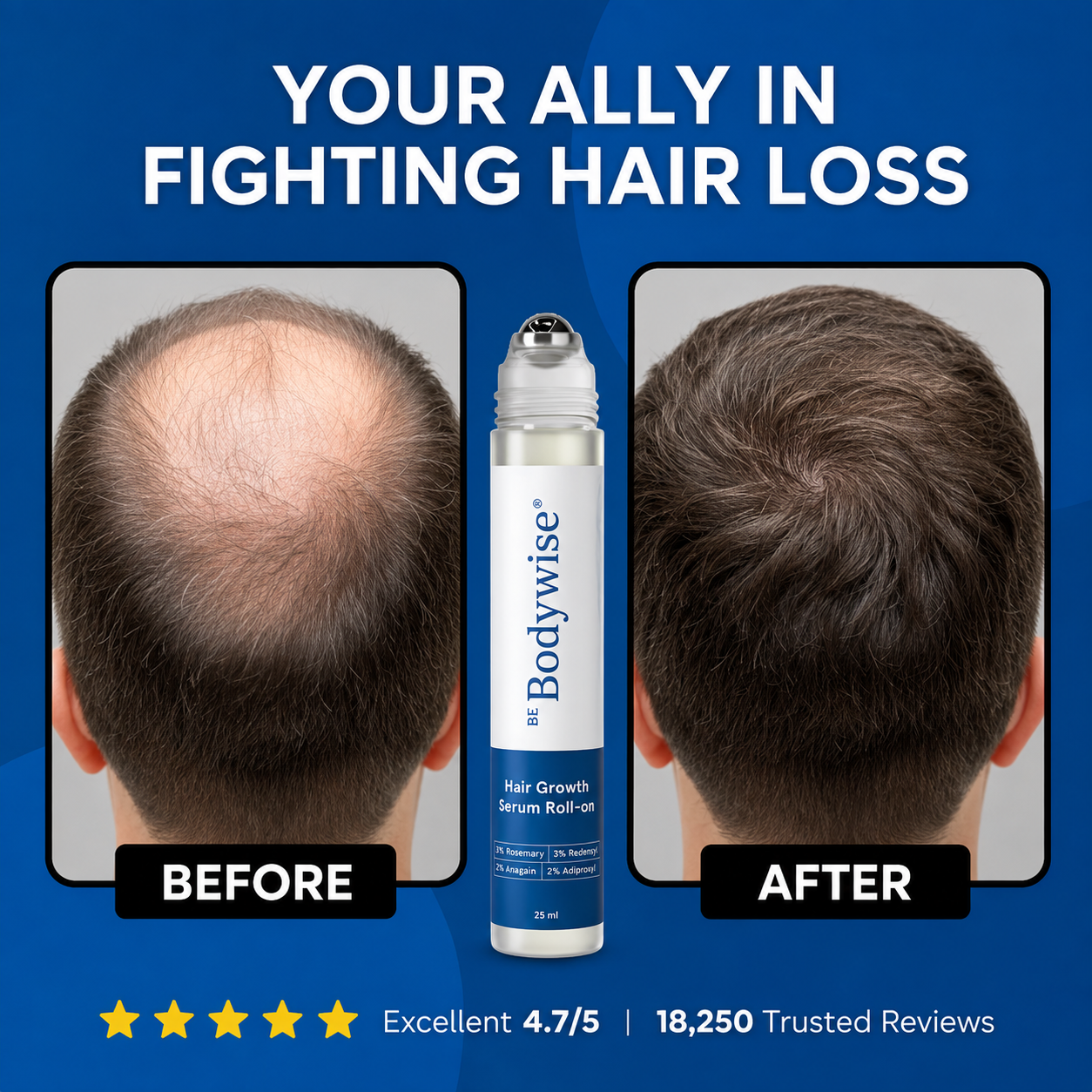 Bodywise Hair Growth Roll on Serum